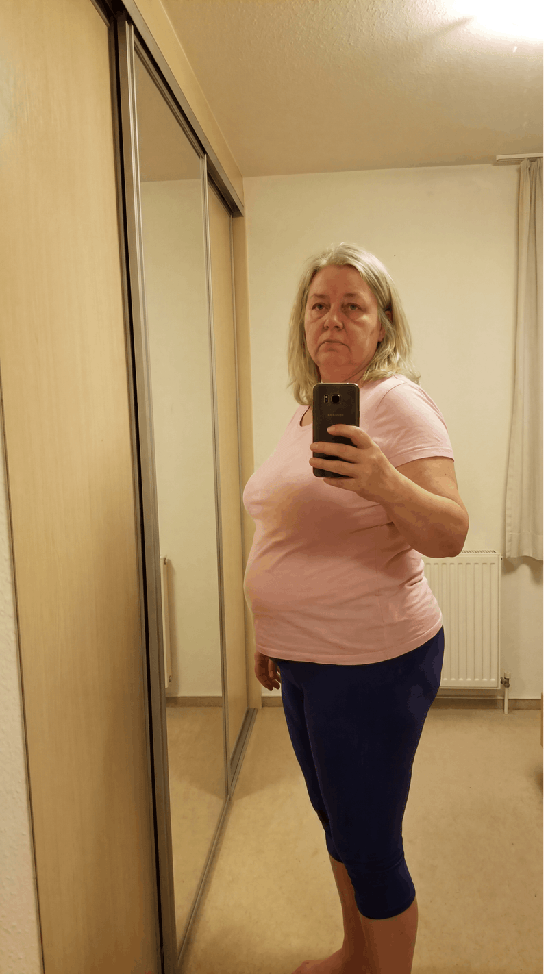 BIRGIT - 52 JAHRE Vorher